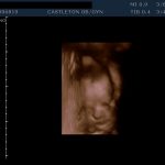 Baby Girl 3d Baby Girl 3d