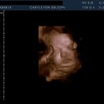 Isn't She Adorable!